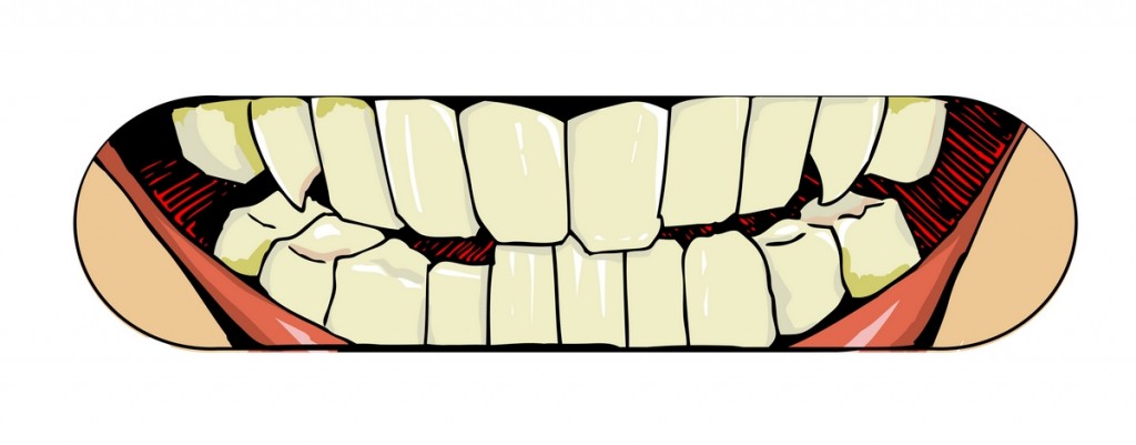  teeth, design for board